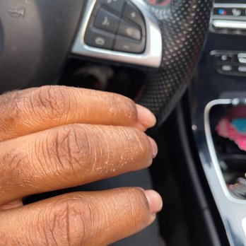 Top Nails - my hand that is peeling now !! - Nail Salons Near Me - Smyrna, Georgia
