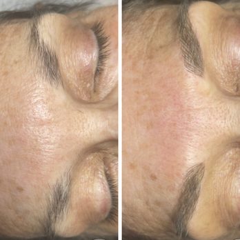 Brows By Tina - Microblading before and after - Permanent Makeup Near Me - Ruskin, Florida Brows By Tina - Microblading before and after - Permanent Makeup Near Me - Ruskin, Florida