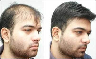 Images International