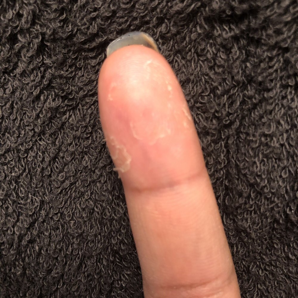 Today's Nails - Peeling skin after trying powder set. (Pic 2 of 2) - Nail Salons Near Me - Anchorage, Alaska Today's Nails - Peeling skin after trying powder set. (Pic 2 of 2) - Nail Salons Near Me - Anchorage, Alaska