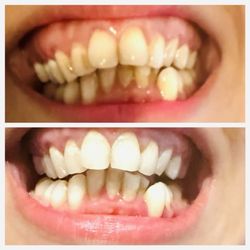Keep It Bright Teeth Whitening Spa - The lady working over here is supper nice and friendly! Very happy with my teeth coming out so white and clean!