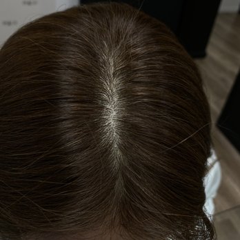 Damo Hair Loss Solution - Today - Hair Loss Centers Near Me - Los Angeles, California