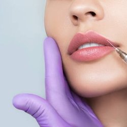 Lip injections