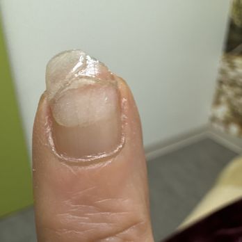 Deluxe Nail Salon - I told Ms Summer I do not like thick nails and she made my nails very thin because she completely removed them!!! - Nail Salons Near Me - Fort Worth, Texas Deluxe Nail Salon - I told Ms Summer I do not like thick nails and she made my nails very thin because she completely removed them!!! - Nail Salons Near Me - Fort Worth, Texas