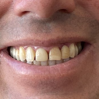Arlington Advanced Dental Care - Before - General Dentistry Near Me - Arlington, Virginia Arlington Advanced Dental Care - Before - General Dentistry Near Me - Arlington, Virginia