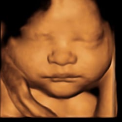Baby in Sight 3D/4D Fetal Ultrasound