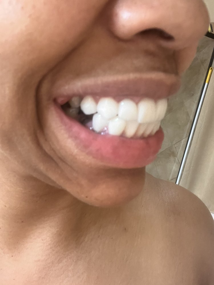 MINT DENTISTRY SUGAR LAND Updated October 2024 39 Photos & 65