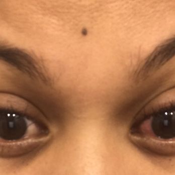 Tudor Nail - Eyes irritated and still burning a day after my lashes were done. Was told by owner and lash professional it was normal to burn - Nail Salons Near Me - Rockaway Park, New York