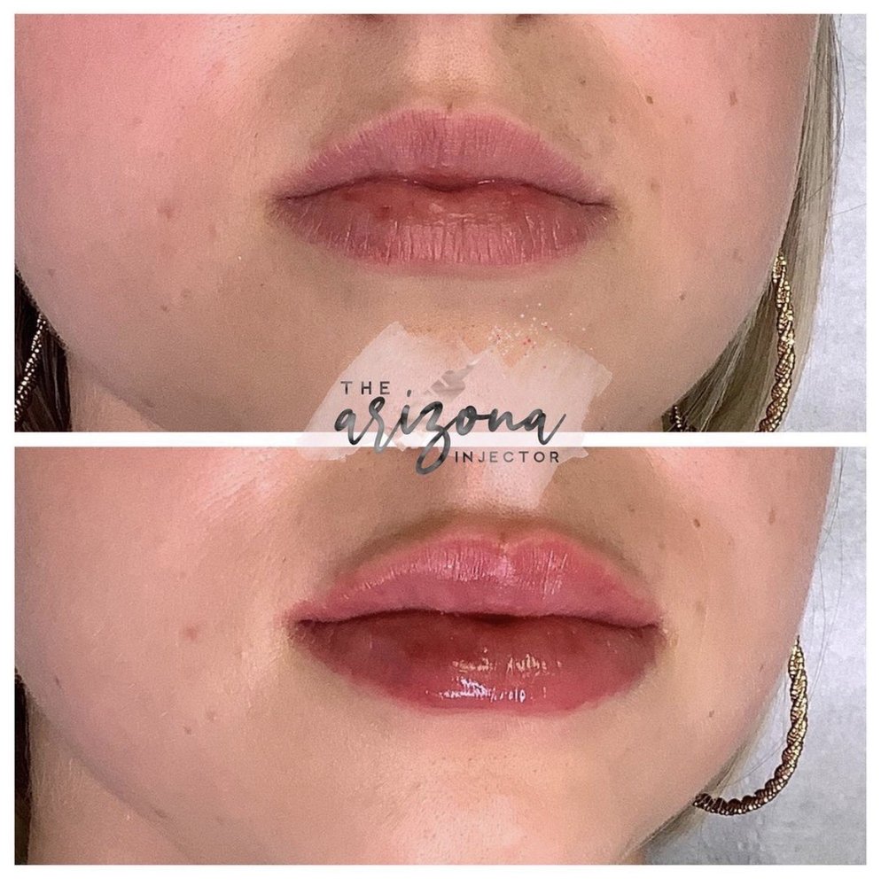 VIDA BELLA MED SPA & WEIGHT LOSS CENTER Updated September 2024 26 Photos & 62 Reviews