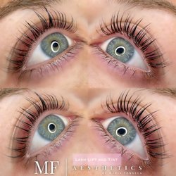 MF Aesthetics - Lash Lift and Tint