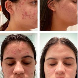 6 month progress 6 month progress