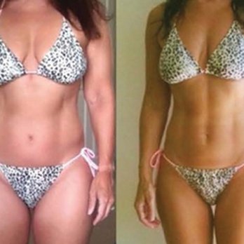 Lite Body Sculpting - Weight Loss Centers Near Me - Citrus Heights, California Lite Body Sculpting - Weight Loss Centers Near Me - Citrus Heights, California