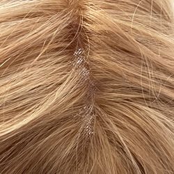 The Lauren Ashtyn Collection - Bald spots.