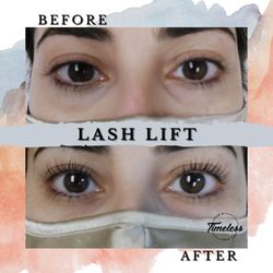 Timeless Laser and Skin Care