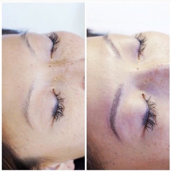 Brow Factor by Betsy - Before and after after first session - Eyebrow Services Near Me Brow Factor by Betsy - Before and after after first session - Eyebrow Services Near Me