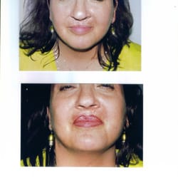 Permanently Yours - Lip Enhancements~Lipliners~& Full Lips