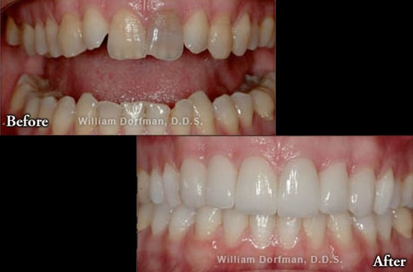 Dr Bill Dorfman Dds Century City Aesthetic Dentistry BILL DORFMAN, DDS - CENTURY CITY AESTHETIC DENTISTRY - Updated July