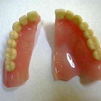 TW Denture Repair - Broken denture: simple repair - Cosmetic Dentists Near Me TW Denture Repair - Broken denture: simple repair - Cosmetic Dentists Near Me