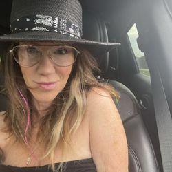 Absolute Medical & Aesthetics - Unfiltered after an Amy treatment