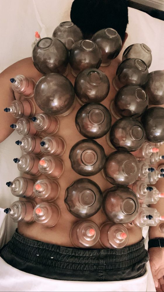 KING’S ACUPUNCTURE 26 Photos & 30 Reviews 19267 Colima Rd, Rowland