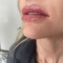 Beyond Beauty Med Spa - Fresh beautiful lips! #Kysse