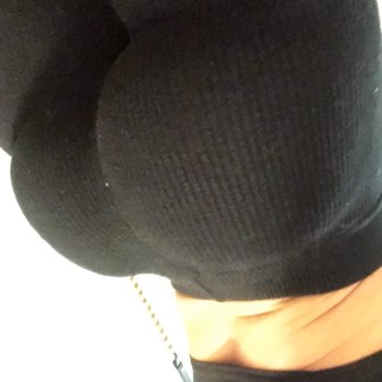 Marina Plastic Surgery - FAT TRANSFER TO MY BUTT BY DR. AZAD - Cosmetic Surgeons Near Me - Pasadena, California