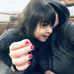 Pediatric Clinic of Garland - The next day after her antibiotics and breathing treatments she was feeling way better! Eating and being silly like she usually is.