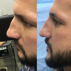 Associates In Otolaryngology