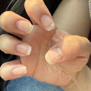 Nail Spa - Nails after nail removal - Nail Salons Near Me - Kent, Washington Nail Spa - Nails after nail removal - Nail Salons Near Me - Kent, Washington