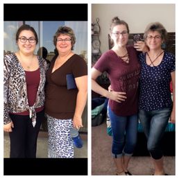 Before and after Daughter/Mother