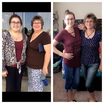 Obesity Control Center - Before and after Daughter/Mother - Weight Loss Centers Near Me - Tijuana, BCN