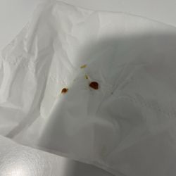 Providence Monroe Walk-In Care - This was just from one ear!