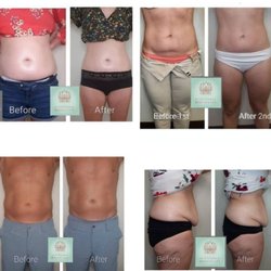 Scottsdale BodySculpt