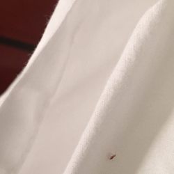 Residence Inn by Marriott - Bed bug in the Marriott.