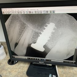 Armitage Oral Surgery - Implant