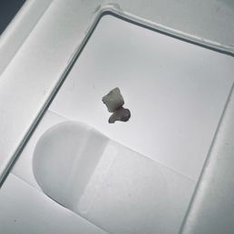 2 of the several plastic fragments that were found in my PBLA(s)