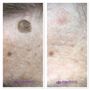 Photo of Mederm Esthetics & Laser