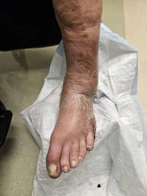 Erie County Medical Center