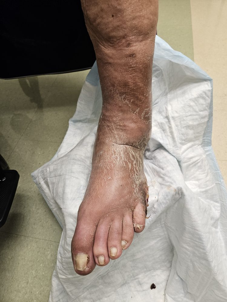 Erie County Medical Center - patient advocate in Buffalo, NY