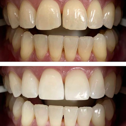 GT Dental Centre - GT Dental Centre: Cosmetic & Family Dentist
308 Dundas Street West; Unit 2
Whitby, ON L1N 2M5
https://www.gtdentalcentre.com/