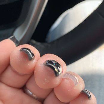 Famous Nails - uneven thick nails, acrylic dried onto the skin. - Nail Salons Near Me - Albuquerque, New Mexico