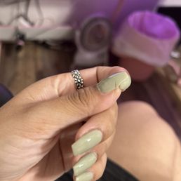 Example of my nail length before coming to apple lounge + one of my two broken nails Example of my nail length before coming to apple lounge + one of my two broken nails