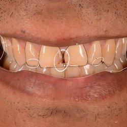 Smile In Style Dental Group of Calabasas - Smile design and planning on iPad - digital