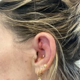 Took piercing abscess
