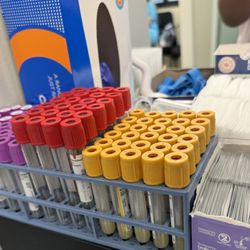 Caring Hands Mobile Phlebotomy - Tubes to keep the blood flow.