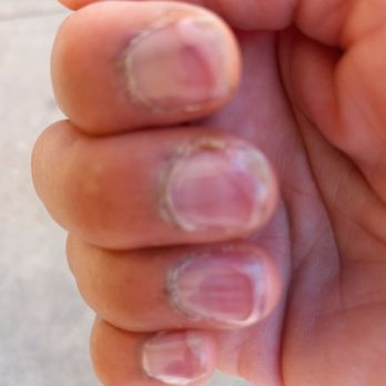 Beauty Lounge Spa - Has you can see after day 4 the product has lifted its self off my nails - Nail Salons Near Me - Carson, California Beauty Lounge Spa - Has you can see after day 4 the product has lifted its self off my nails - Nail Salons Near Me - Carson, California