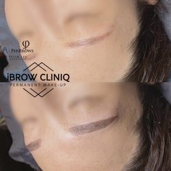 iBROW CLINIQ - 4D Combo Brows (Microblading + Microshading)