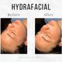 Photo of Innovative Aesthetics Medical Spa and Laser Center