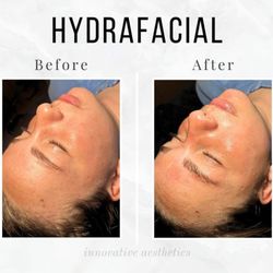 Innovative Aesthetics Medical Spa and Laser Center