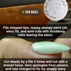 Spa Nails - Mutilated and messy